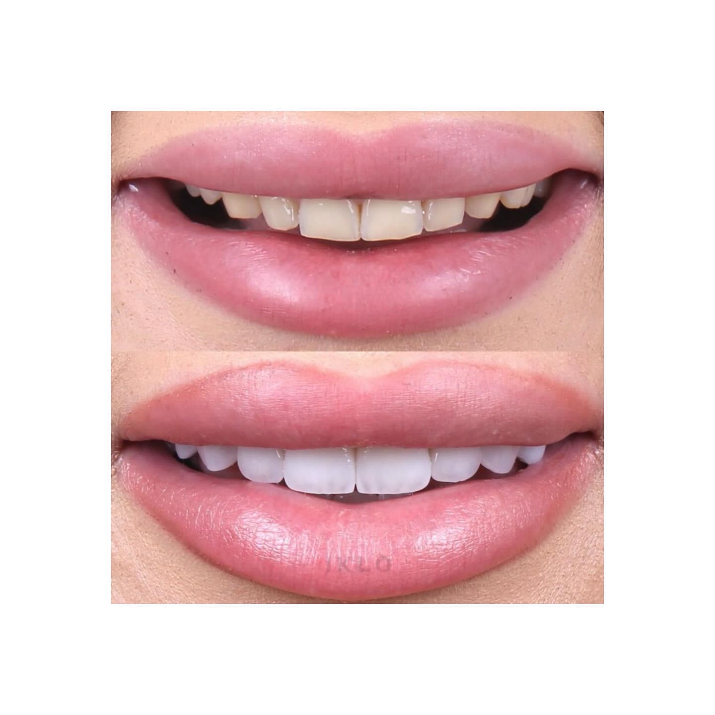 Estética